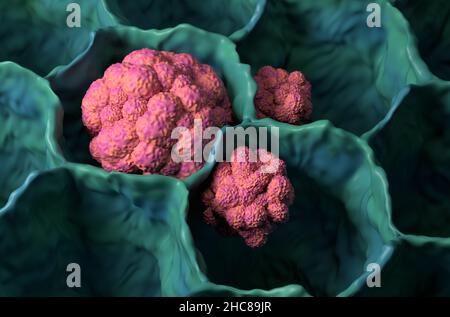 Lungenkrebs Tumor Mikrobiologie 3D Illustration Nahaufnahme Stockfoto