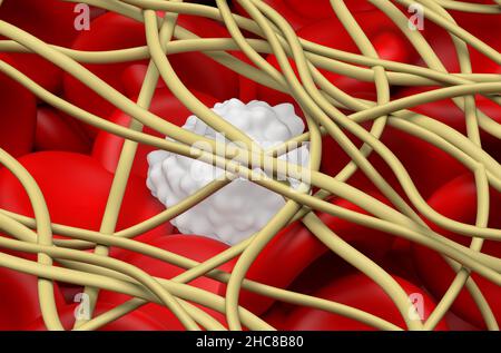 Blutgerinnsel. Die roten Blutkörperchen und eine weiße Blutkörperchen sind in Filamenten aus Fibrin-Protein gefangen. Nahaufnahme Ansicht 3D Abbildung Stockfoto