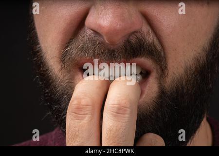 Porträt eines jungen nervösen, stressigen Mannes, der Nägel beißt, als ob er Angst vor etwas schlechtem, isoliertem schwarzem Hintergrund hätte Stockfoto