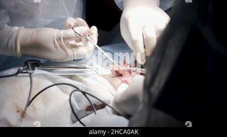 Nahaufnahme von professionellen Chirurgen, die während eines medizinischen Eingriffs eine offene Wunde nähen. Ärzte in sauberer Uniform mit Katgut, um die Operation zu beenden. Stockfoto