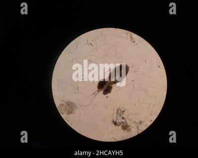 Inferiore Krustentiere unter der Mikroskopvergrößerung. Hochwertige Fotos Stockfoto