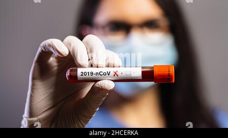Krankenschwester, die das Reagenzglas mit Blut für 2019-nCoV-Analysen hält. Neuartiges chinesisches Coronavirus Bluttestkonzept Stockfoto