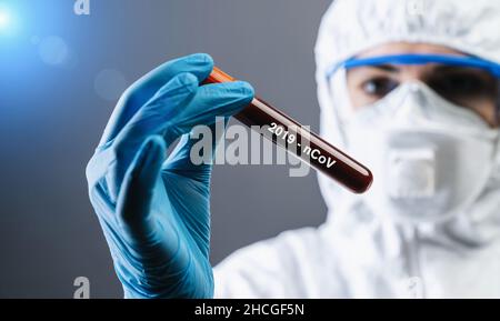 Coronavirus COVID 19 NCoV-Ausbruch. Medizinische oder wissenschaftliche Holding Corona Virus Blut-Teströhrchen vom Patienten. Positiver Fall von Korona Virus Europe, Ita Stockfoto