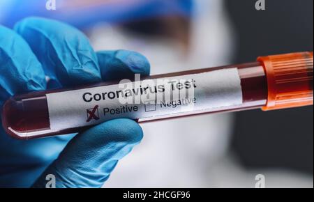 Arzt oder Krankenschwester in Schutzanzug und Gesichtsschutz mit positivem Bluttest auf Coronavirus oder Covid-19. Stockfoto