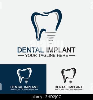 Zahnimplantat Logo Vektor Designs Konzept , Dental Clinic & Care Logo-Vorlage Stock Vektor