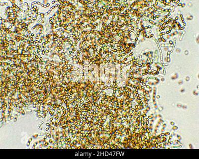 Aphanthecealgen unter mikroskopischer Ansicht, Cyanobakterien, Blaualgen Stockfoto