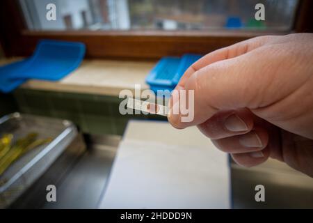 Der Simicon-Test mit biologischen Indikatoren wird in einem Krankenhaus durchgeführt Stockfoto