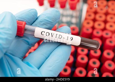 Hand hält ein Glas Reagenzglas mit dem Blut des Patienten für den Test von Covid-19 Stockfoto