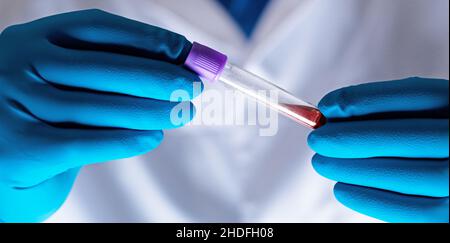 Blutprobe, Bluttest, Blutentnahmeröhrchen, Blutproben, Bluttests Stockfoto