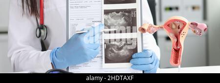 Gynäkologe zeigt Ultraschall des Uterus in der Nahaufnahme des Büros Stockfoto