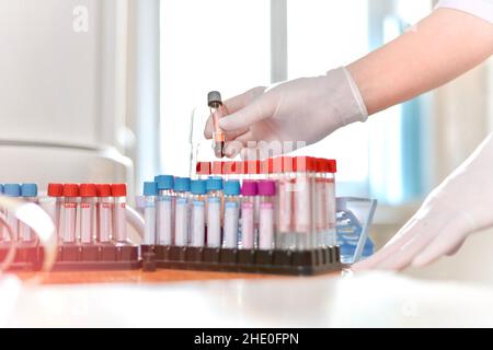 Ein mit Blut gefülltes Reagenzglas zur Analyse, in den Handflächen in Handschuhen eine Krankenschwester. In einem Labor oder Behandlungsraum, unter den vielen medizinischen Röhren auf einem Ständer. Stockfoto