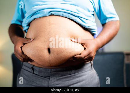 Unkenntlich Fat man Kontrolle durch Schütteln Bauchfett - Konzept der ungesunden Lebensweise, Messung von Übergewicht Körperfett Stockfoto
