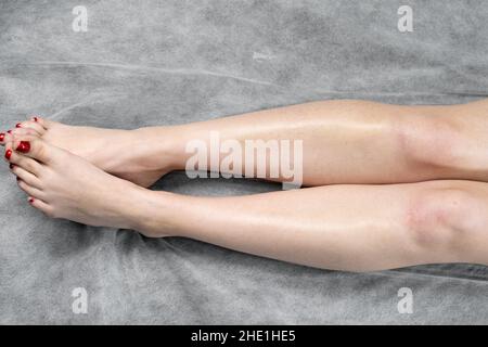 Bild vor und nach Konzept der Haarentfernung an weiblichen Beinen in einem Schönheitssalon. Stockfoto