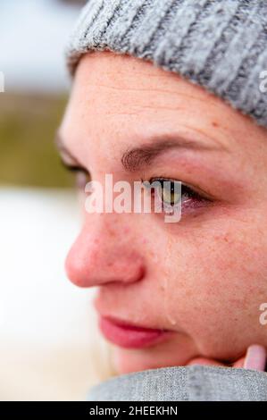 Nahaufnahme einer jungen Frau, die an gefrorenen Wintertagen einen Strickmütze aus Wolle trägt, einen warmen Schal und Fäustlinge mit Tropfenabfall am Auge trägt Stockfoto