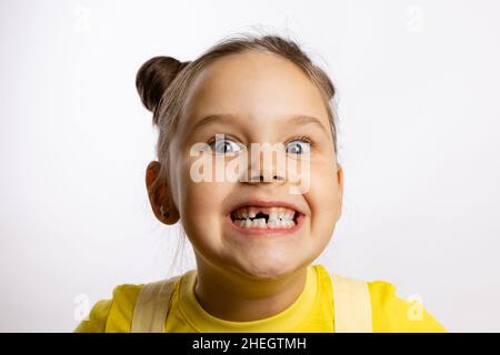Porträt eines kleinen Mädchens mit fehlenden Babyzahn vorne und einem verrückten Lächeln mit prall gefüllten Augen in gelbem T-Shirt auf weißem Hintergrund. Erste Zähne Stockfoto