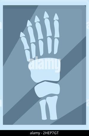 Xray Hand Scan Symbol Cartoon Vektor. Knochentest. Radiologie des Arztes Stock Vektor