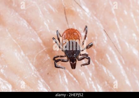 Europäische Rizinusbohne, Europäische Schafszecke (Ixodes ricinus), sitzt auf der menschlichen Haut, Deutschland Stockfoto