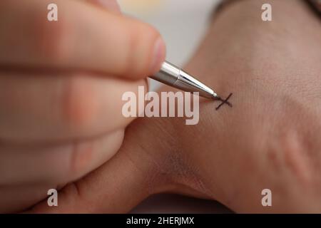 Mann macht x mit Kreuz mit Stift auf der Hand, Nahaufnahme Stockfoto