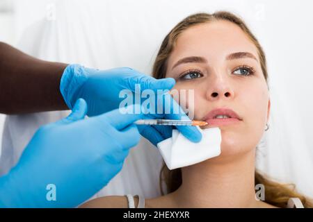 Junge Frau bekommt Verfahren der Lippenvergrößerung in der Kosmetologie Klinik Stockfoto