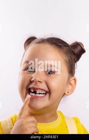 Hübsches Mädchen mit geöffnetem Mund, das auf einen fehlenden vorderen Milchzahn zeigt, mit einem verrückten Fingerlächeln und Blick auf die Kamera auf weißem Hintergrund. Erste Zähne Stockfoto