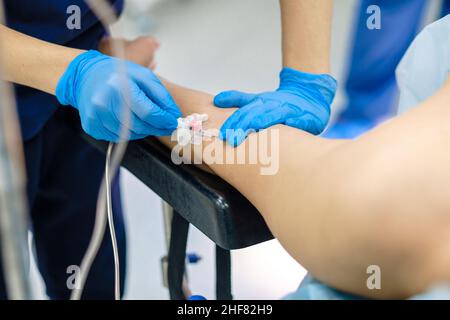 Installieren eines Katheters für einen medizinischen Tropfer im Arm des Patienten. Selektiver Fokus. Der Arzt in sterilen Handschuhen legt den Patienten zur intravenösen Verabreichung von Medikamenten in einen Tropf. Stockfoto