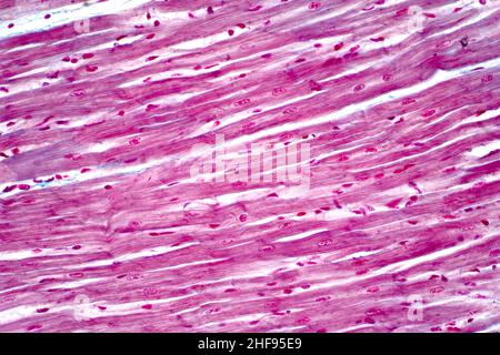 Herzmuskel, leichte Mikrograph Stockfoto