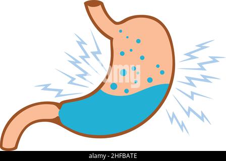 Vektordarstellung „Magenproblem“ Stock Vektor