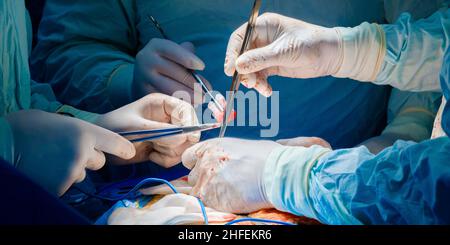 Ein Team professioneller Chirurgen operiert mit medizinischen Instrumenten an einem Patienten. Selektiver Fokus. Die Hände der Ärzte während einer Operation. Stockfoto