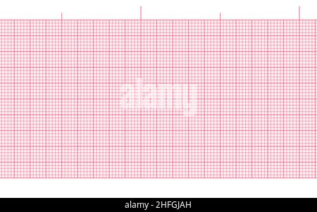 Rosafarbenes, leeres ekg-Papier mit nahtlosem Hintergrund für die Aufzeichnung der Herzfrequenz. Digitales ekg-Diagramm Klinikseite. Millimeterdiagramm-Vektorraster. Geometrisches Pat Stock Vektor