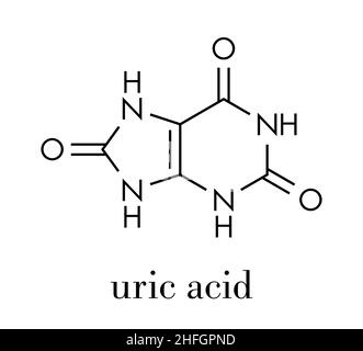 Harnsäure Molekül. Hohe Blutspiegel führen zu Gicht erkrankung. Skelettmuskulatur Formel. Stock Vektor