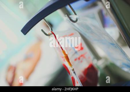 Bluttropfsystem, das am Haken des medizinischen Pfahls auf dem Hintergrund des Patienten hängt, der im Bett liegt. Stockfoto