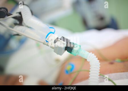 Patient auf der Intensivstation, der an das künstliche Beatmungssystem der Lunge angeschlossen ist. Stockfoto