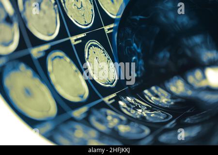 Human Brain Scan Testfilm gefaltet in einer Rolle, medizinischen Hintergrund mit Platz für Ihr Design. Stockfoto