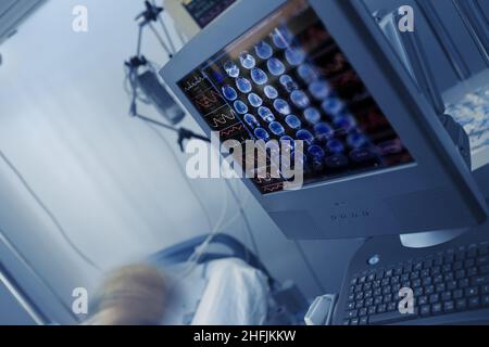 EKG- und CT-Untersuchungsbilder auf dem Computermonitor auf der Krankenhausstation am Patientenbett. Stockfoto