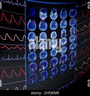 CT-Film und EKG-Überwachung als medizinisches Konzept zur Früherkennung von Gefäßerkrankungen. Stockfoto