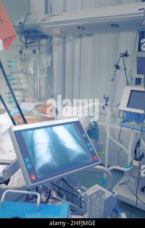 Röntgenuntersuchung des Thorax des Patienten auf dem Display eines medizinischen Computers auf der Krankenhausstation. Konzept anspruchsvoller Technologien in der Medizin. Stockfoto