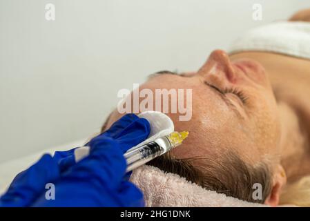 Botulinumtoxin-Injektion auf die Augenpartie, zum Heben der Haut um die Augen, Mesotherapie. Stockfoto