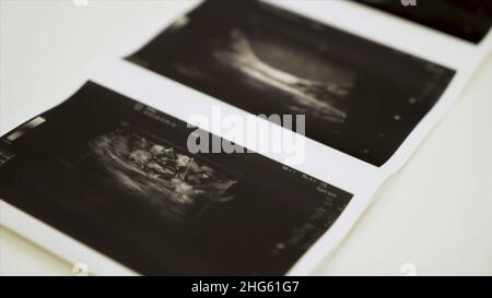 Sammlung von Bildern aus Ultraschalluntersuchungen. Nahaufnahme von monochromen Bildern der inneren menschlichen Organe, Konzept der Medizin. Stockfoto
