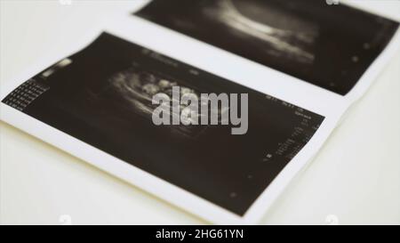 Sammlung von Bildern aus Ultraschalluntersuchungen. Nahaufnahme von monochromen Bildern der inneren menschlichen Organe, Konzept der Medizin. Stockfoto
