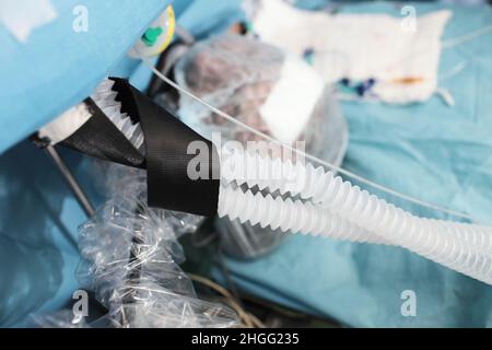 Schlafender Patient während der Operation, der an das Beatmungsgerät angeschlossen ist. Stockfoto