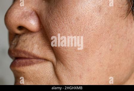 Vergrößerte Poren im Gesicht des südostasiatischen, chinesischen älteren Mannes mit Hautfalten. Stockfoto