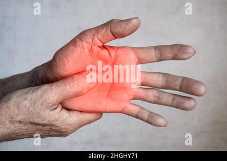 Schmerzhafter Palmaraspekt des asiatischen alten Mannes. Konzept des Kompartiment-Syndroms, Zellulitis und Schmerzen der Handmuskulatur. Stockfoto