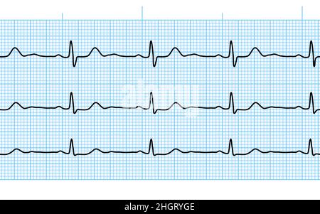 Herzschlag-ekg oder ekg nahtlose schwarze Linie auf blauem Papier. Elektrokardiogramm-Diagramm der Herz-Kreislauf-Heilungsrate. Untersuchung der menschlichen Gesundheit. Medizintestwagen Stock Vektor