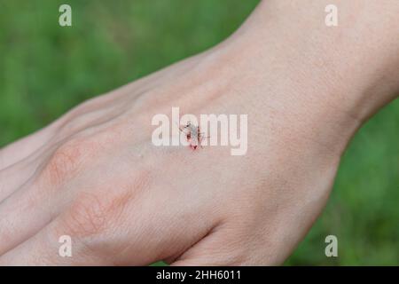 Nahaufnahme der getöteten Mücke mit viel Blut auf der Hand. Moskito ernährt sich vom Blut des menschlichen Körpers. Stockfoto