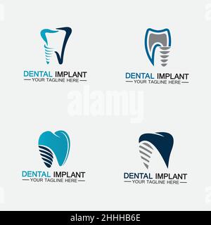 Set Dental Implantat Logo Vektor Designs Konzept , Dental Clinic & Care Logo-Vorlage Stock Vektor