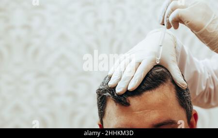 Ein Kosmetologe führt Anti-Aging-Verfahren durch, wendet Hyaluronsäure-Serum auf die Haut an, um das Haarwachstum zu fördern Stockfoto