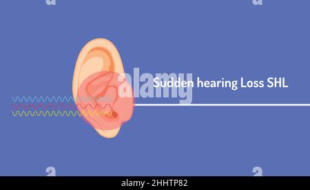 Plötzlicher Hörverlust shl rot gefährliche Clircle-Symbol bedeuten, dass ein Signal Wellenlinie in ein Ohr, aber nicht hören kann, ist direkte Linie. Körperteil schönen Colo Stock Vektor