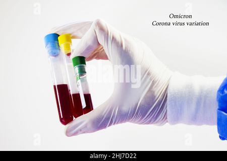 Die Hand eines Wissenschaftlers, der Omicron-Probenröhrchen mit Blut hält Stockfoto