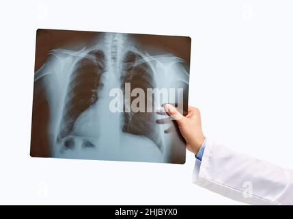 Mann Hand hält eine Lunge Radiographie isoliert auf einem weißen Hintergrund Stockfoto