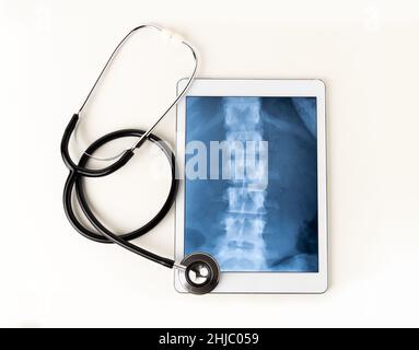 Ein Tablet und ein Stethoskop vor weißem Hintergrund Stockfoto